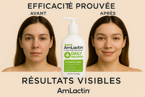 Avant/Après AmLactin Daily Nourish - résultats visibles peau lisse hydratée éclatante efficacité prouvée