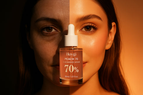 Image 9 - Avant/AprÚs créative