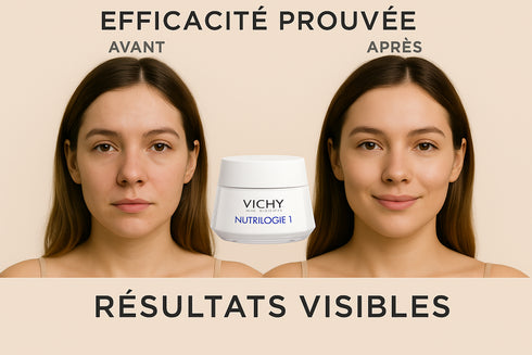 Avant/Après Vichy Nutrilogie 1 - résultats visibles peau hydratée lumineuse éclatante efficacité prouvée
